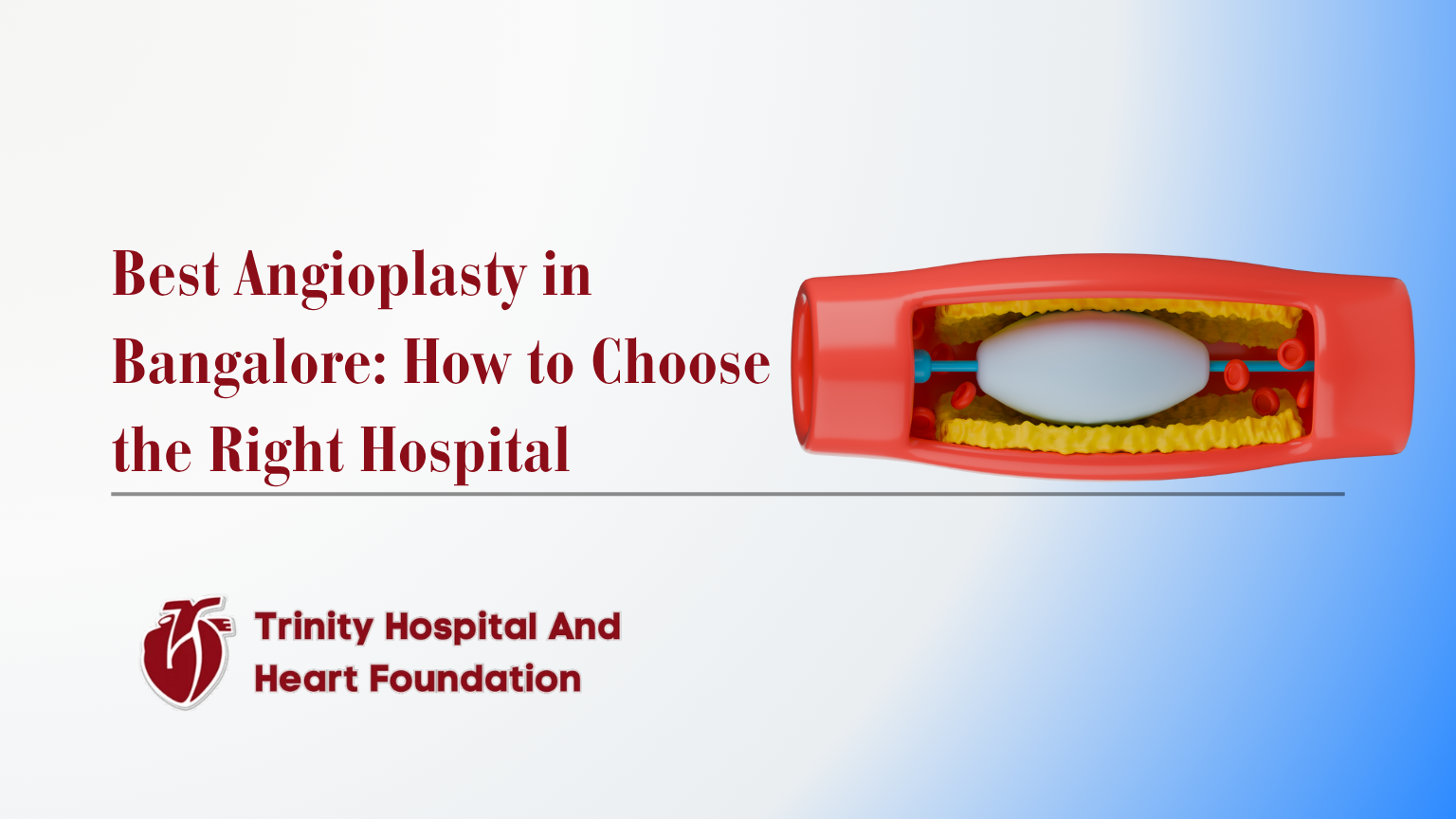 Best Angioplasty in Bangalore: How to Choose the Right Hospital