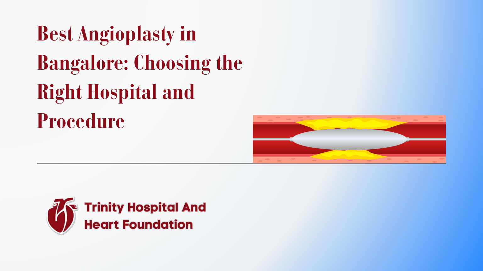 Best Angioplasty in Bangalore: Choosing the Right Hospital and Procedure