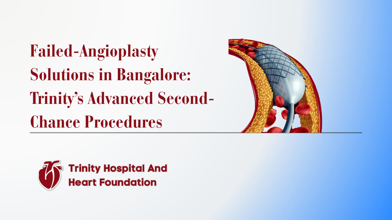 Failed-Angioplasty Solutions in Bangalore: Trinity’s Advanced Second-Chance Procedures