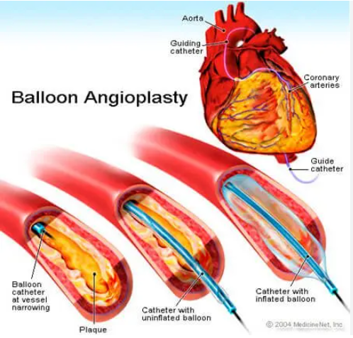 Medical illustration