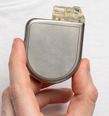 Close-up photo of a CRT-D device used for cardiac resynchronization therapy and defibrillation