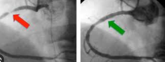 Medical professional preparing a patient for a cardiac CT scan using advanced coronary imaging machine
