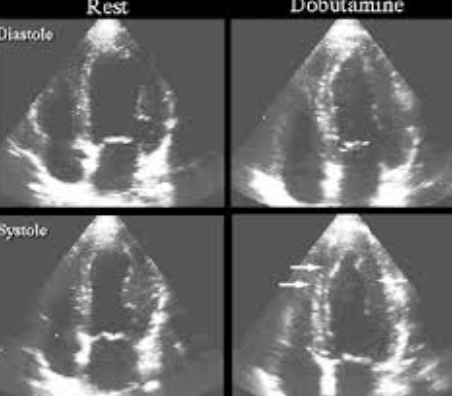Medical professional performing a stress echocardiogram scan to visualise a patient's heart on a monitor