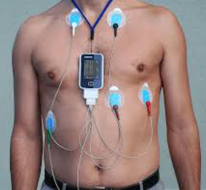 Multi-lead cardiac event recorder with colour-coded electrodes on a patient's torso for continuous heart rhythm tracking