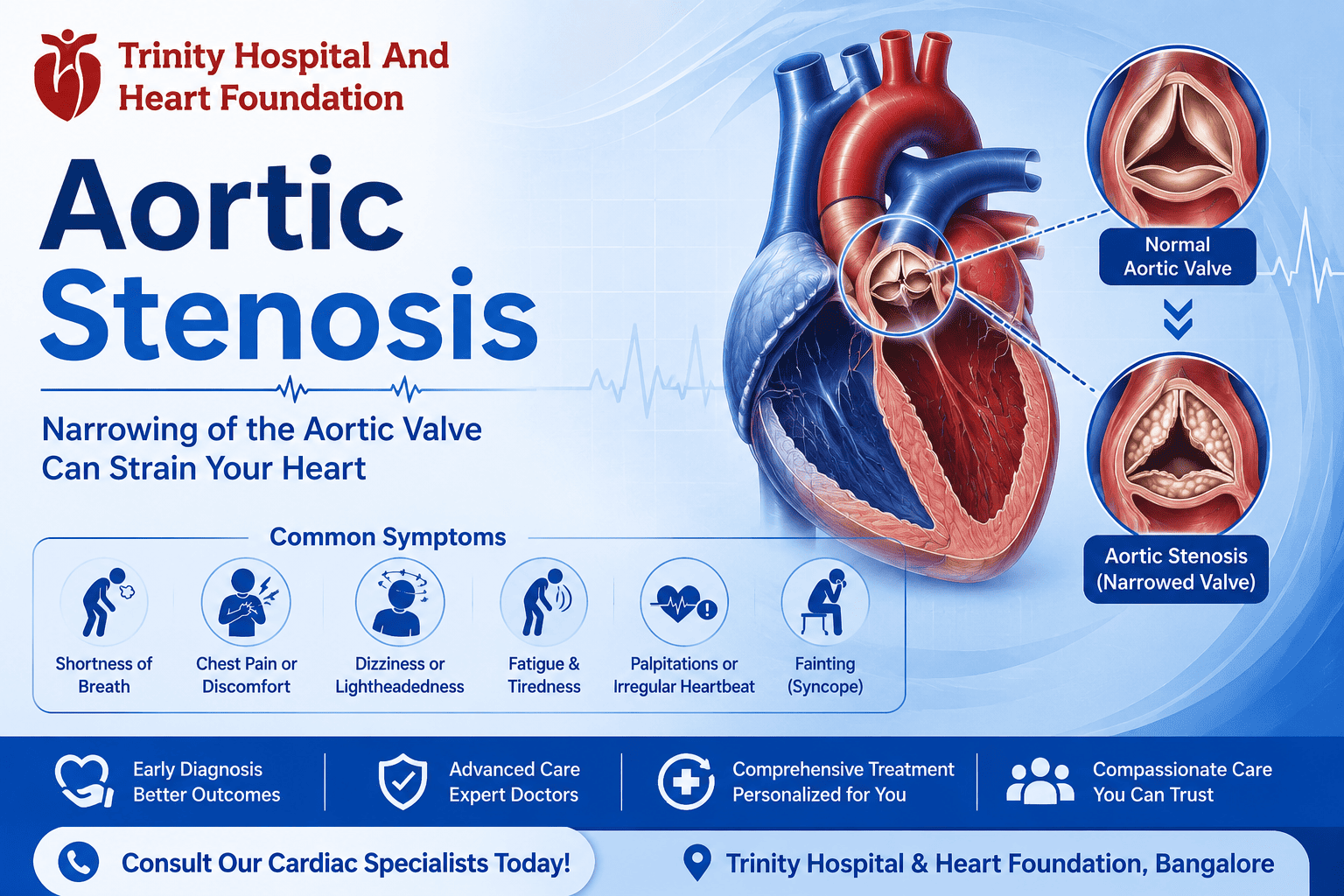 Educational infographic about aortic stenosis from Trinity Hospital showing a heart diagram with narrowed aortic valve and symptom icons at the bottom panel.