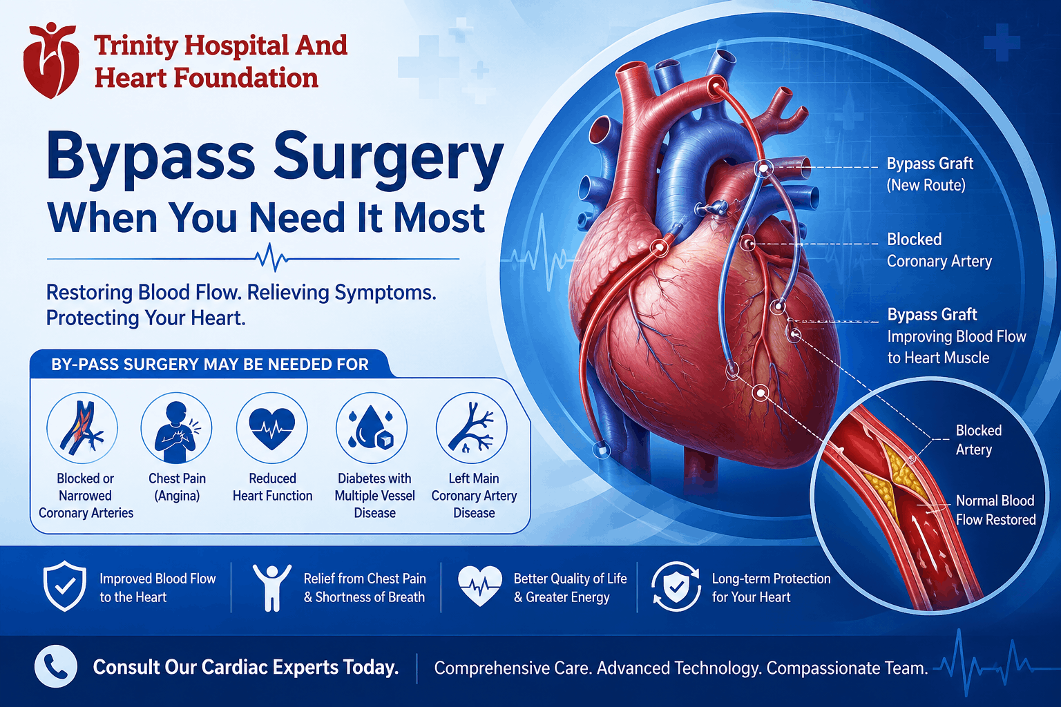 Medical infographic about bypass surgery: heart diagram with labeled grafts and arrows on a blue background, explaining the procedure and benefits for patients.",