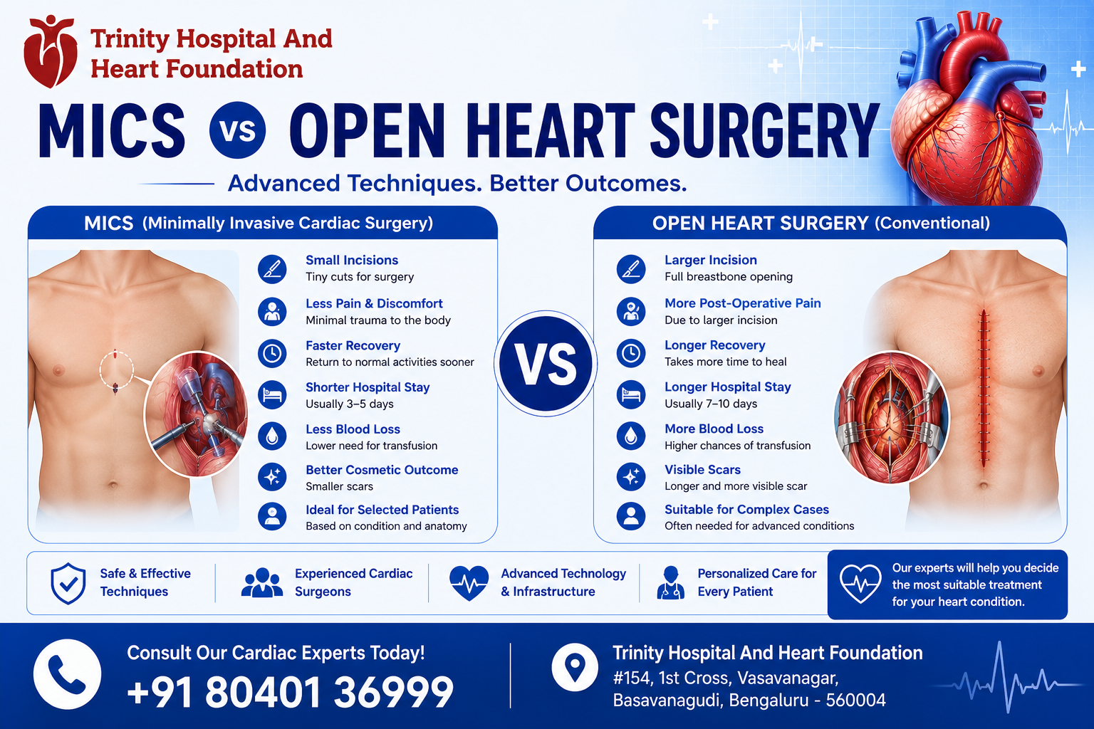 Mics vs open heart - Trinity Hospital & Heart Foundation Educational infographic comparing MICS (minimally invasive) vs open heart surgery, with a central VS and benefits listed on each side and a heart graphic. (Trinity Hospital branding)