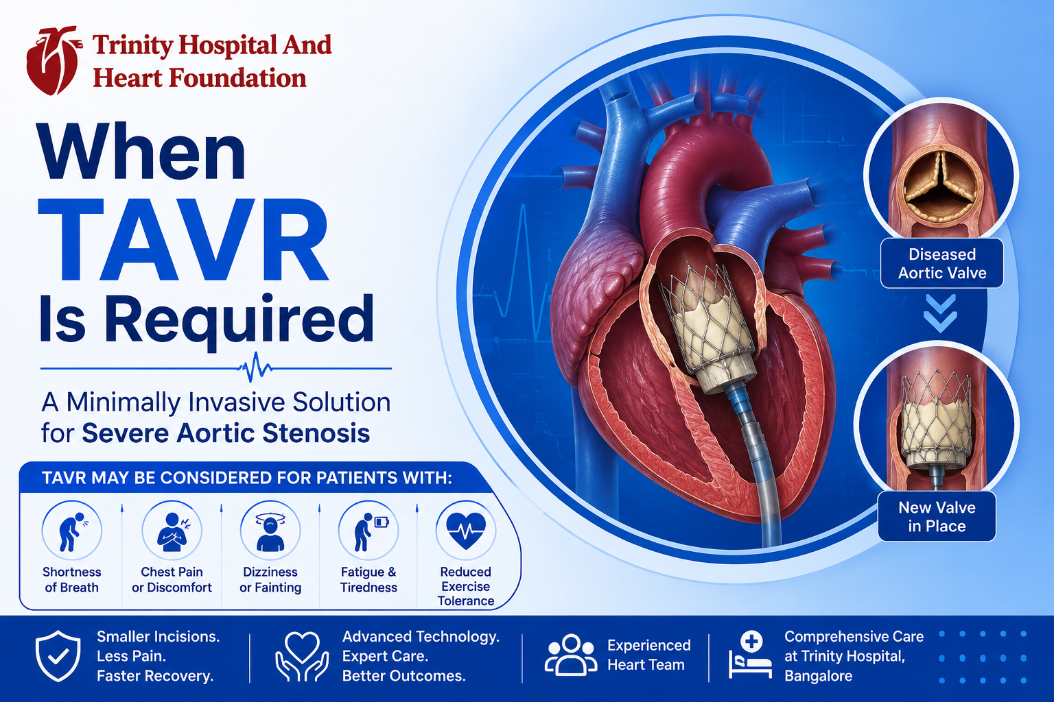 Tavr - Trinity Hospital & Heart Foundation tavr